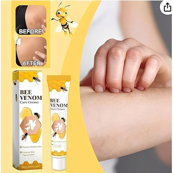 Fivfivgo Vitigo Bee Venom Correcting Cream 20g | Skin Tone Balancing And Pigmentation Repair Cream For Even, Healthy-Looking Skin - GlowLaa.com