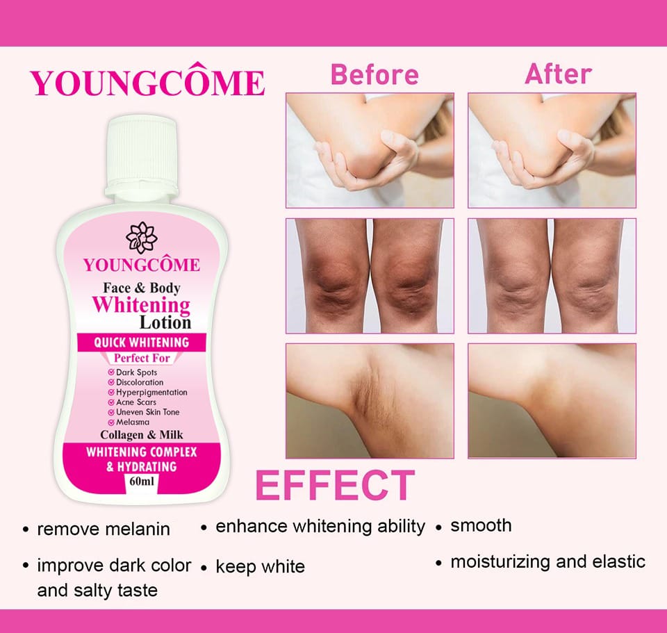 YOUNGCOME 60ml Face Body Whitening Lotion Underarm Brightening Private Underarm Body Cream Legs Whitening Parts