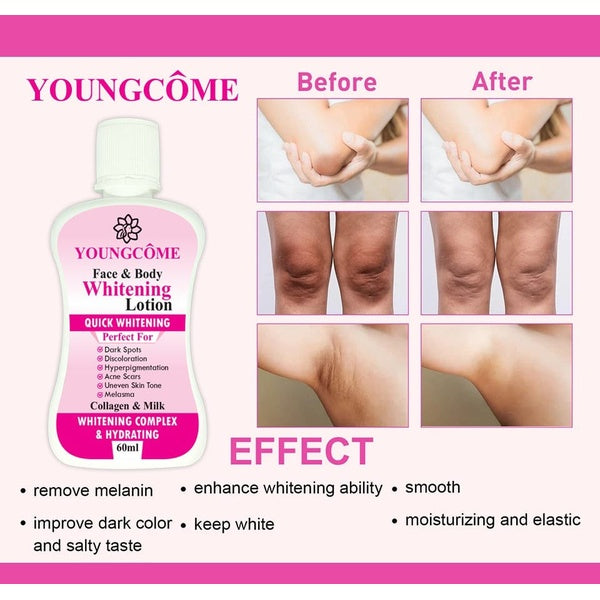 YOUNGCOME 60ml Face Body Whitening Lotion Underarm Brightening Private Underarm Body Cream Legs Whitening Parts