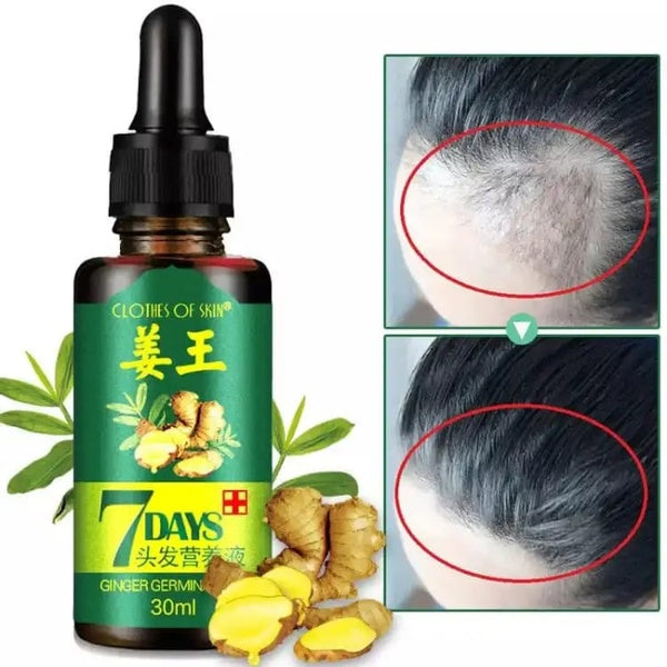 original 7 Days Hair Growth Germinal Serum Oil (30ML) - GlowLaa.com