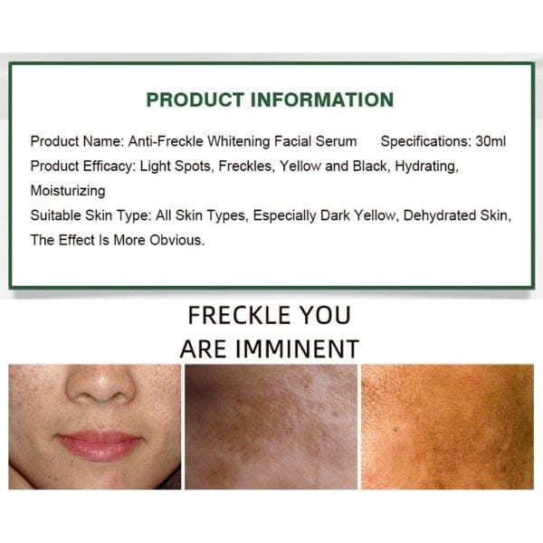 100% original Aichun Anti Freckle Whitening Facial Serum 30ml