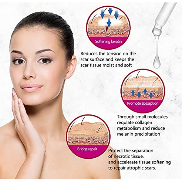 AICHUN BEAUTY Scar Removal Facial Serum Pimples Stretch Marks Face Moisturizing Body Remove Scars Kojic Acid Vitamin E 30ml