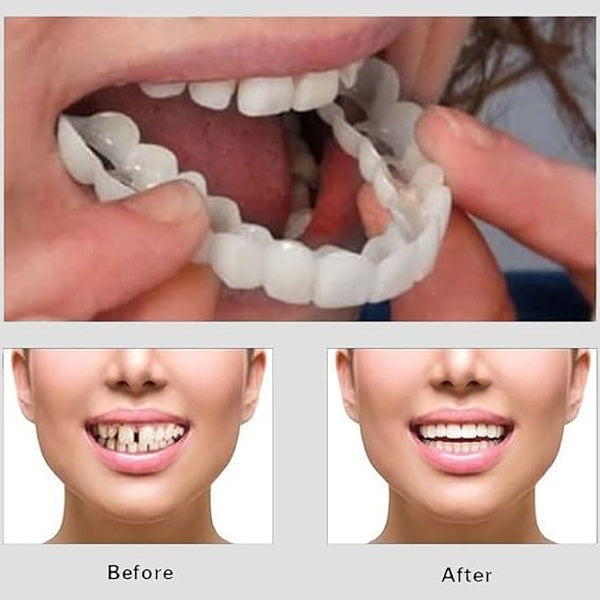 Snap On Smile - Veneers Teeth for Men and Women - Moldable False Artificial Braces Teeth - GlowLaa.com