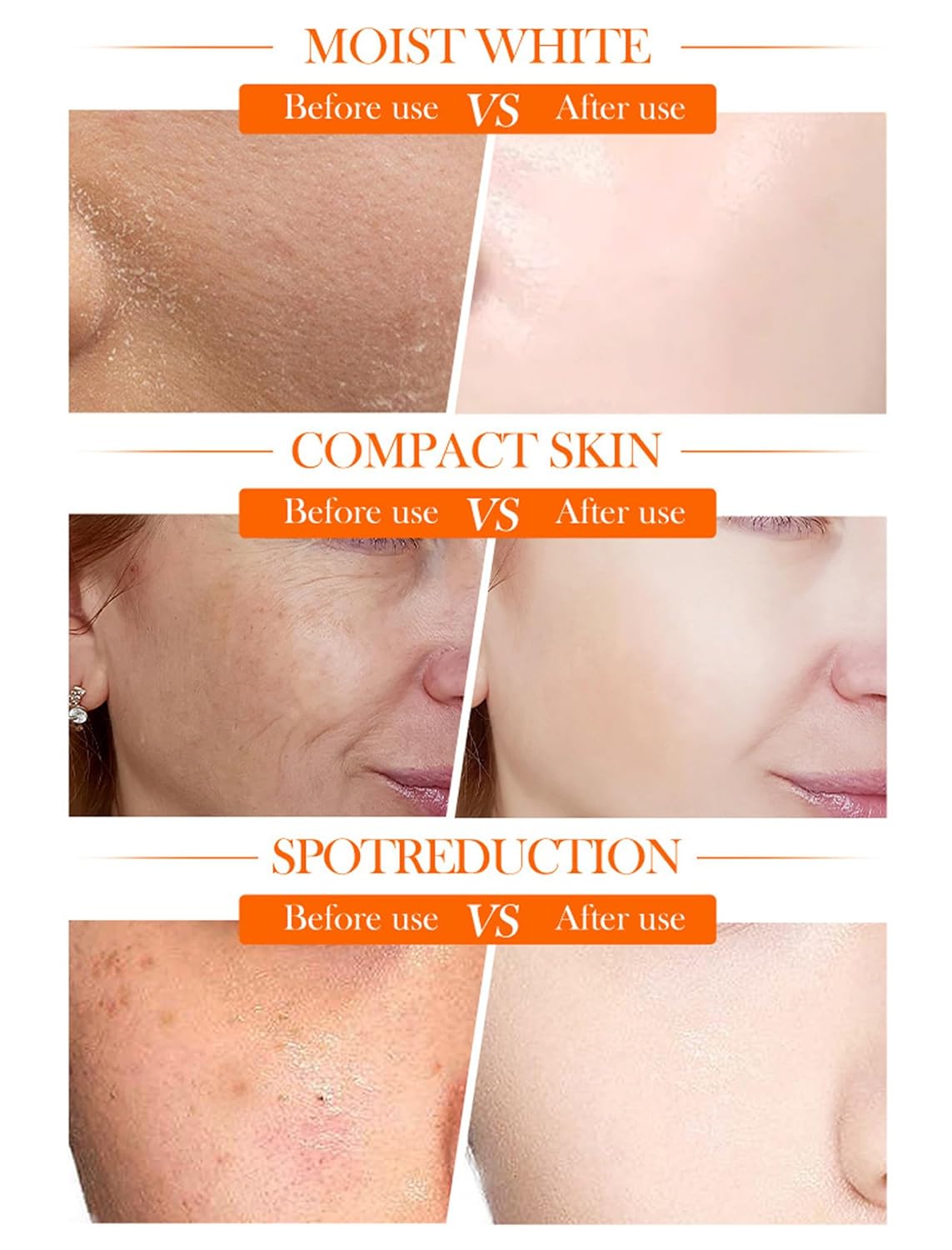 Sadoer 5x Vitamin C Skin Active whitening Cream | Vitamin C Hydrating Face Cream - Glowing &amp; Repairing Moisturizer for Fine Lines, Wrinkles &amp; Uneven Skin Tone | Whitening Cream