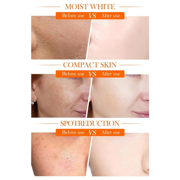 Sadoer 5x Vitamin C Skin Active whitening Cream | Vitamin C Hydrating Face Cream - Glowing &amp; Repairing Moisturizer for Fine Lines, Wrinkles &amp; Uneven Skin Tone | Whitening Cream - GlowLaa.com