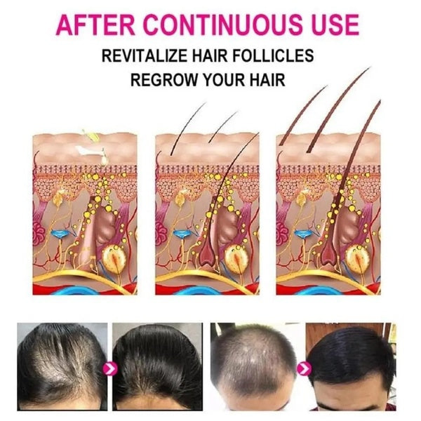 Anti-Grey Hair Serum, 30Ml - GlowLaa.com