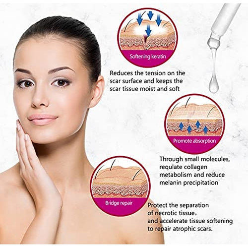 AICHUN BEAUTY Scar Removal Facial Serum Pimples Stretch Marks Face Moisturizing Body Remove Scars Kojic Acid Vitamin E 30ml